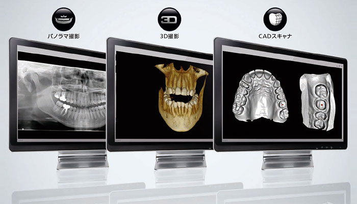 治療の精度を上げる歯科用CT