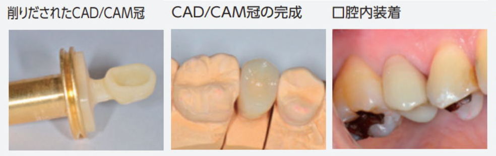 cad/cam